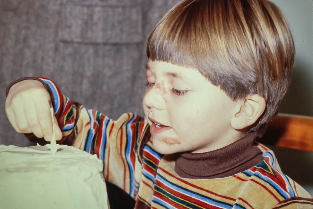 Andrew Birthday after sledding accident - December 1980